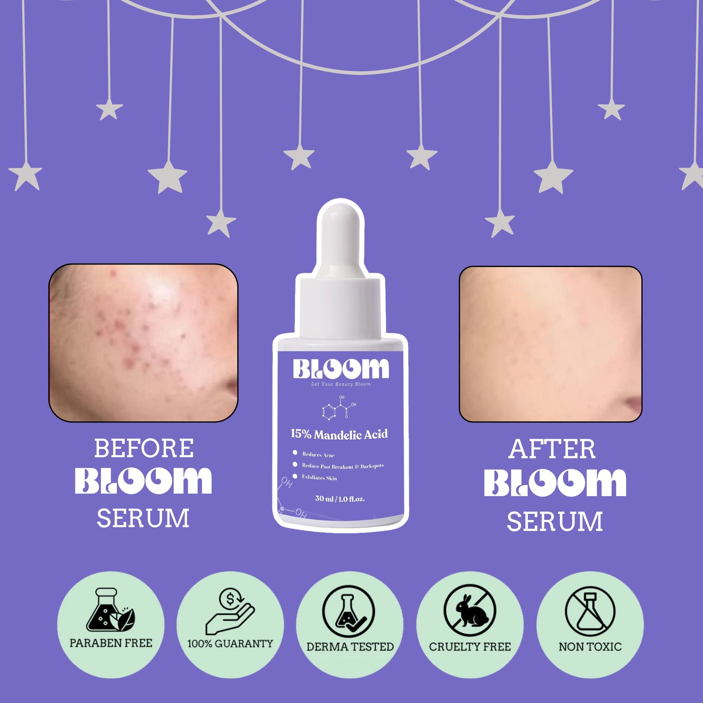 Bloom™ Mandelic Acid Serum