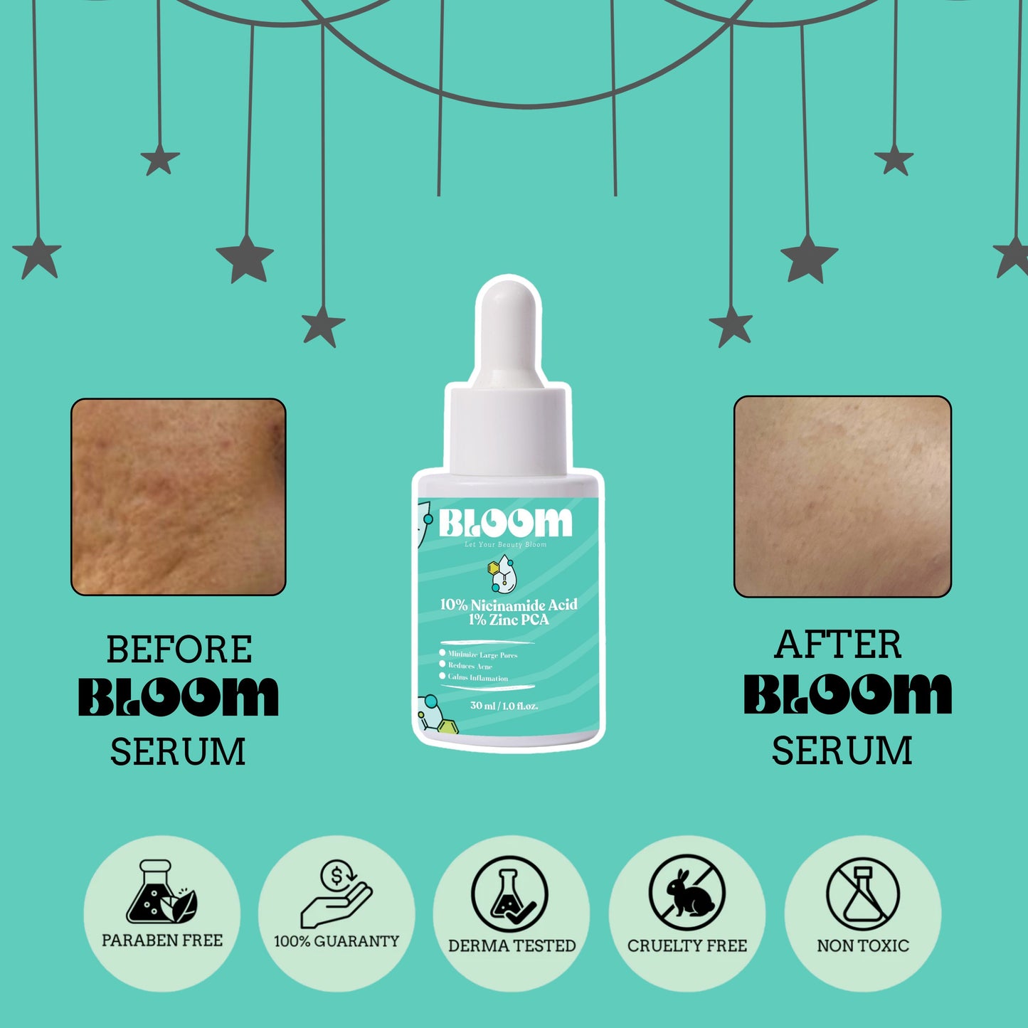Bloom™ Nicinamide Acid + Zinc Serum